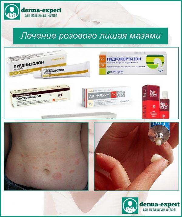 Лечение розового лишая мазями