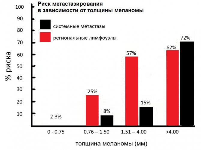 Метастазирование меланомы