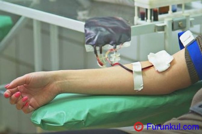 Переливание крови при фурункулах